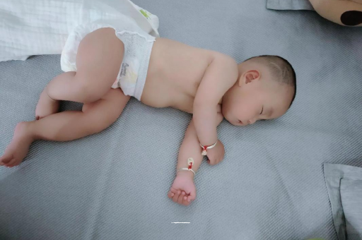 简阳宝宝头上长痱子